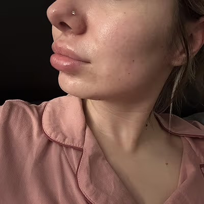 فوم شستوشو ضدجوش و پاککننده عمیق پوست مدیکیوب | مناسب پوست چرب و مستعد آکنه